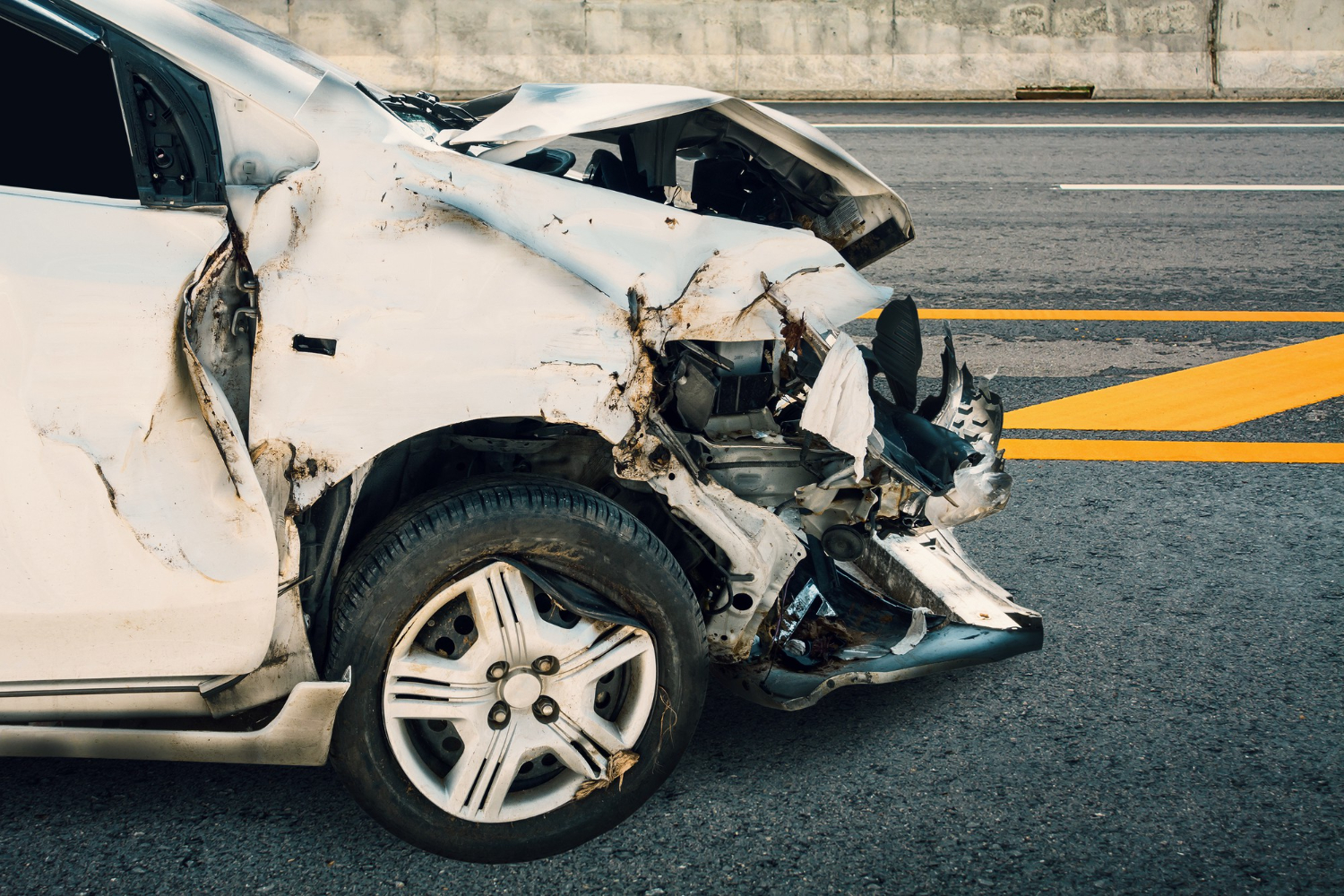 Personal Injury